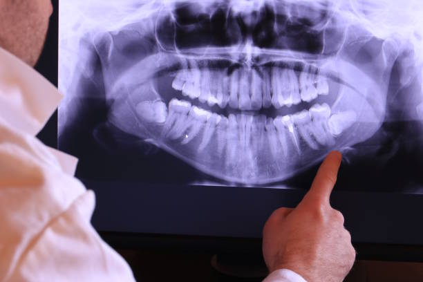 Best Emergency Tooth Extraction in Sweetwater, TN